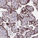 C19orf52 Antibody in Immunohistochemistry (Paraffin) (IHC (P))