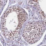 C19orf52 Antibody in Immunohistochemistry (Paraffin) (IHC (P))
