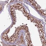 C3orf70 Antibody in Immunohistochemistry (Paraffin) (IHC (P))