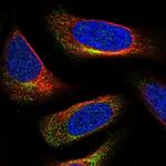 C3orf70 Polyclonal Antibody