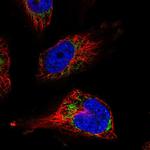 UQCRFS1 Polyclonal Antibody