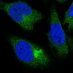 PPP4R4 Polyclonal Antibody