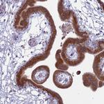 TMEM208 Polyclonal Antibody