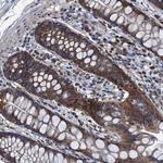 DDX49 Polyclonal Antibody