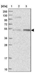 DDX49 Antibody in Western Blot (WB)