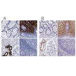 RHCG Polyclonal Antibody