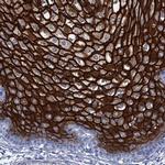 RHCG Antibody in Immunohistochemistry (IHC)