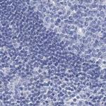 RHCG Antibody in Immunohistochemistry (IHC)