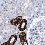 RHCG Antibody in Immunohistochemistry (IHC)