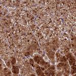 KIAA1680 Polyclonal Antibody