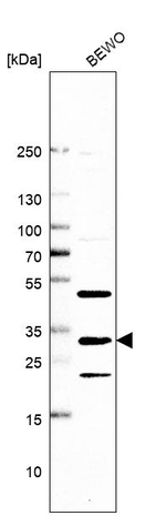 MVB12A Antibody in Western Blot (WB)