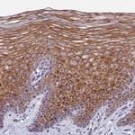 MVB12A Antibody in Immunohistochemistry (IHC)