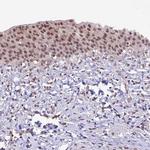 SHKBP1 Antibody in Immunohistochemistry (IHC)