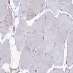 HN1L Antibody in Immunohistochemistry (Paraffin) (IHC (P))