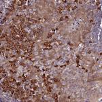 HN1L Antibody in Immunohistochemistry (Paraffin) (IHC (P))