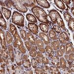 HN1L Antibody in Immunohistochemistry (IHC)