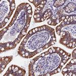 AP4E1 Polyclonal Antibody