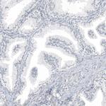 PLA2G10 Antibody in Immunohistochemistry (Paraffin) (IHC (P))