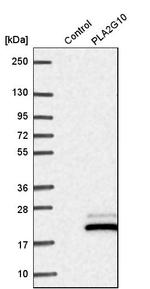 PLA2G10 Antibody in Western Blot (WB)