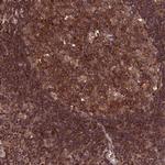 PKD2L2 Antibody in Immunohistochemistry (Paraffin) (IHC (P))