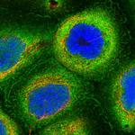 HN1L Polyclonal Antibody