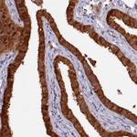 HN1L Antibody in Immunohistochemistry (Paraffin) (IHC (P))