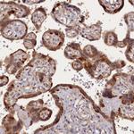 HN1L Antibody in Immunohistochemistry (Paraffin) (IHC (P))