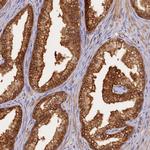 HN1L Antibody in Immunohistochemistry (Paraffin) (IHC (P))