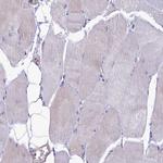 HN1L Antibody in Immunohistochemistry (Paraffin) (IHC (P))