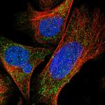 DDX28 Polyclonal Antibody