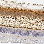 UNC119 Polyclonal Antibody