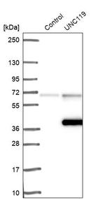 UNC119 Antibody in Western Blot (WB)