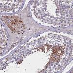 PDILT Polyclonal Antibody