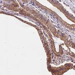 BLACE Polyclonal Antibody