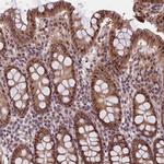 F1A alpha Antibody in Immunohistochemistry (Paraffin) (IHC (P))