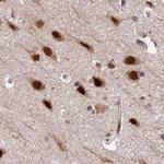 FAM103A1 Antibody in Immunohistochemistry (IHC)