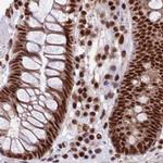 FAM103A1 Antibody in Immunohistochemistry (IHC)