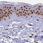 FAM103A1 Antibody in Immunohistochemistry (IHC)