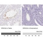 SPACA4 Antibody in Immunohistochemistry (IHC)