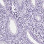 SPACA4 Antibody in Immunohistochemistry (IHC)