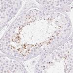 SPACA4 Antibody in Immunohistochemistry (IHC)