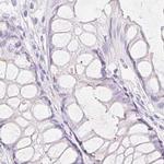 SPACA4 Antibody in Immunohistochemistry (IHC)