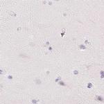 SPACA4 Antibody in Immunohistochemistry (IHC)