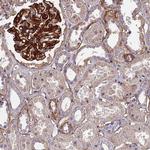 EVA1B Antibody in Immunohistochemistry (IHC)