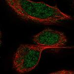 BTBD9 Antibody in Immunocytochemistry (ICC/IF)