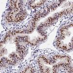 BTBD9 Antibody in Immunohistochemistry (Paraffin) (IHC (P))