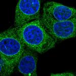 PRKCSH Antibody in Immunocytochemistry (ICC/IF)