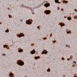 FAM103A1 Antibody in Immunohistochemistry (IHC)