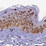 FAM103A1 Antibody in Immunohistochemistry (IHC)