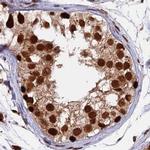 FAM103A1 Antibody in Immunohistochemistry (IHC)